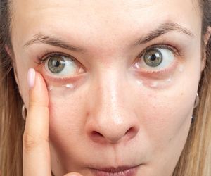 Chcesz się pozbyć worków pod oczami? To pierwszy krok, by je wyeliminować