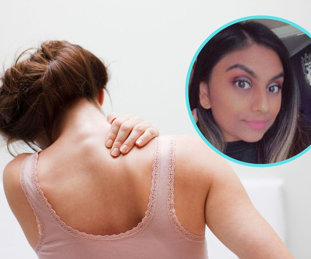 To nie było ukąszenie owada. Padła o wiele gorsza diagnoza. 21-latka zmarła kilka miesięcy później