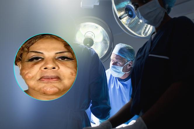 Sala operacyjna - zbliżenie na chirurgów