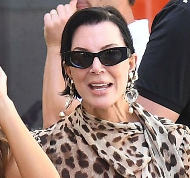 Kupiła sobie nową twarz za 360 tysięcy złotych! Nie poznasz tej gwiazdy