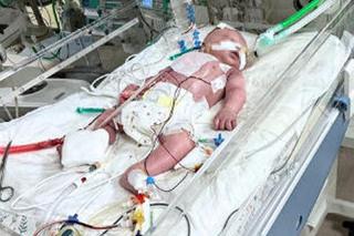 Mały Krzyś ma połowę serduszka, ale rodzice kochają go całym sercem. Ruszyła zbiórka [ZDJĘCIA]