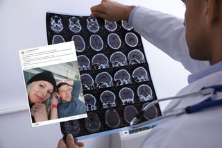Guz w jego mózgu rósł 10 lat. Mrowienie i zmęczenie sygnalizowały problem
