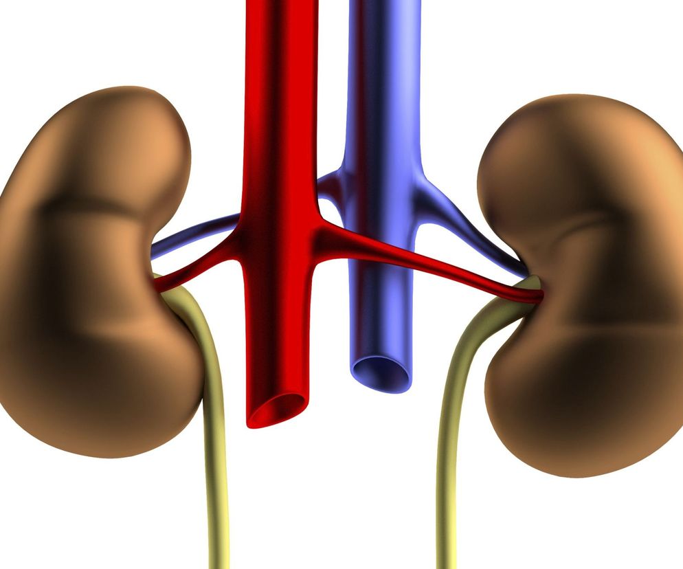 Na czym polega przeszczep krzyżowy nerek? Jakie są zalety tej metody transplantacji?