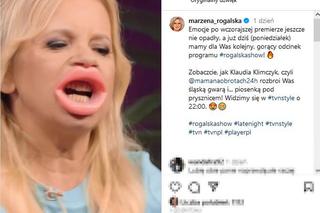 Ogromne usta Marzeny Rogalskiej! Co ona z sobą zrobiła?!