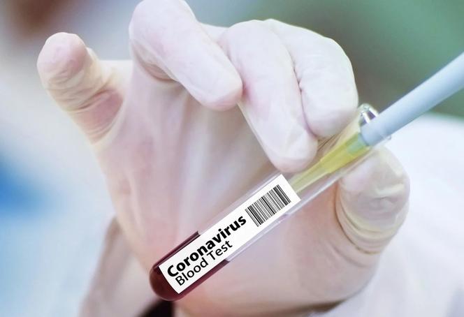 Koronawirus w Polsce. Ile dziś nowych zakażeń i zgonów? Relacja na żywo