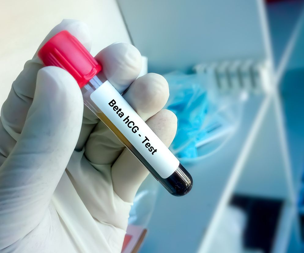Próbka krwi Beta hCG