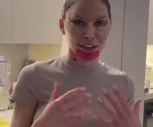 Julia von Stein po operacji