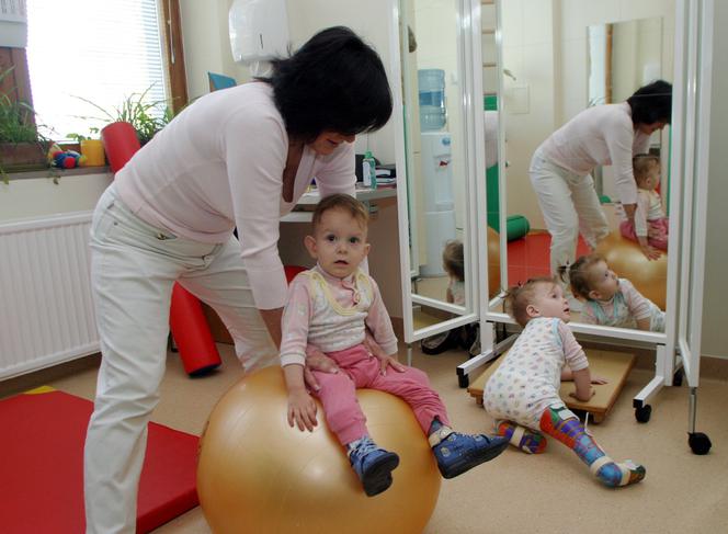 Bliźniaczki syjamskie z Janikowa