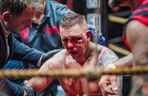 GROMDA 21: Zmasakrowana twarz Górala w walce