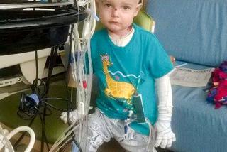 Moja skóra mnie zabija