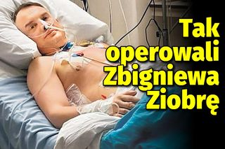 Tak operowali Zbigniewa Ziobrę! Zdjęcie polityka mówi, jak wiele musiał przejść