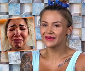 Uczestniczka Hotelu Paradise brutalnie pobita. Pokazała drastyczne zdjęcia