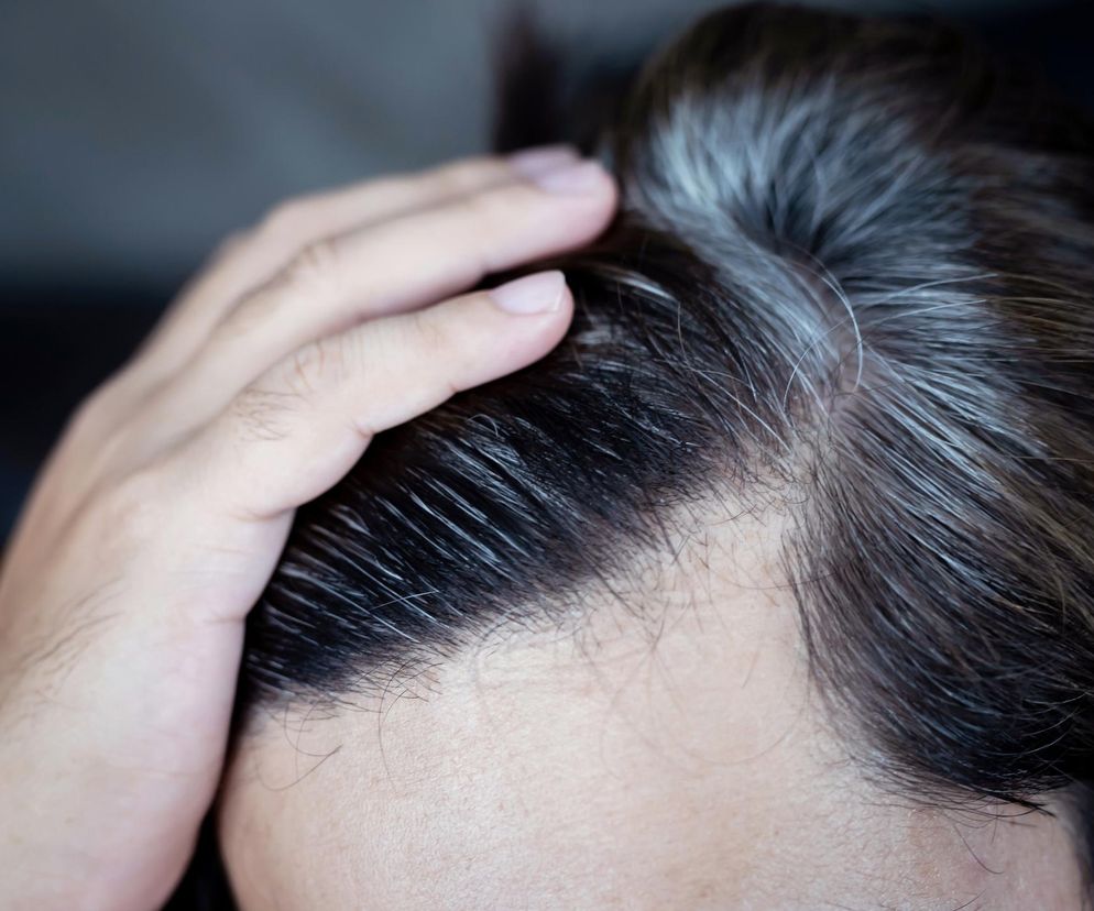 Nałóż cebulę na siwe włosy. Zapomnisz o drogich zabiegach u fryzjera