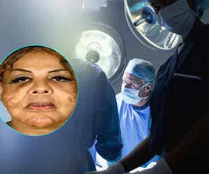 Padła ofiarą pseudochirurga. Wstrzyknął jej cement i uszczelniacz do opon pod skórę. Tak dziś wygląda