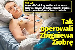 Tak operowali Zbigniewa Ziobrę