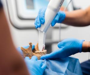 Dentyści z Katowic badają zęby wampirów z Gliwic