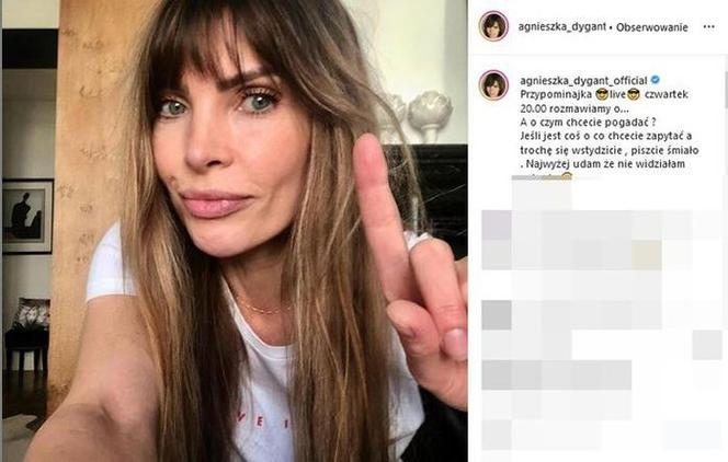 To aparat na zęby zmienił Agnieszce Dygant twarz