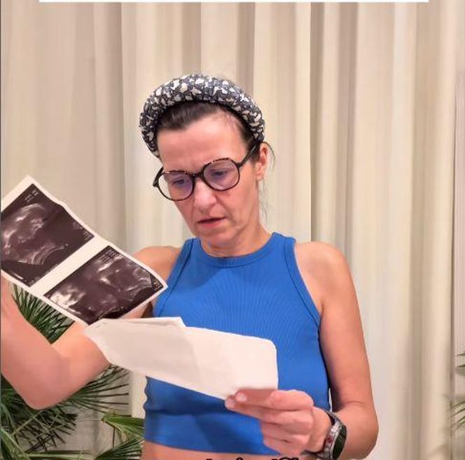 Koroniewska i Dowbor niespodziewanie pokazali USG