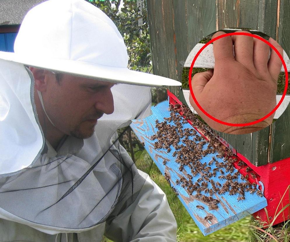 Pszczoły zaatakowały Kukiza! Dłoń spuchła mu jak beczka!