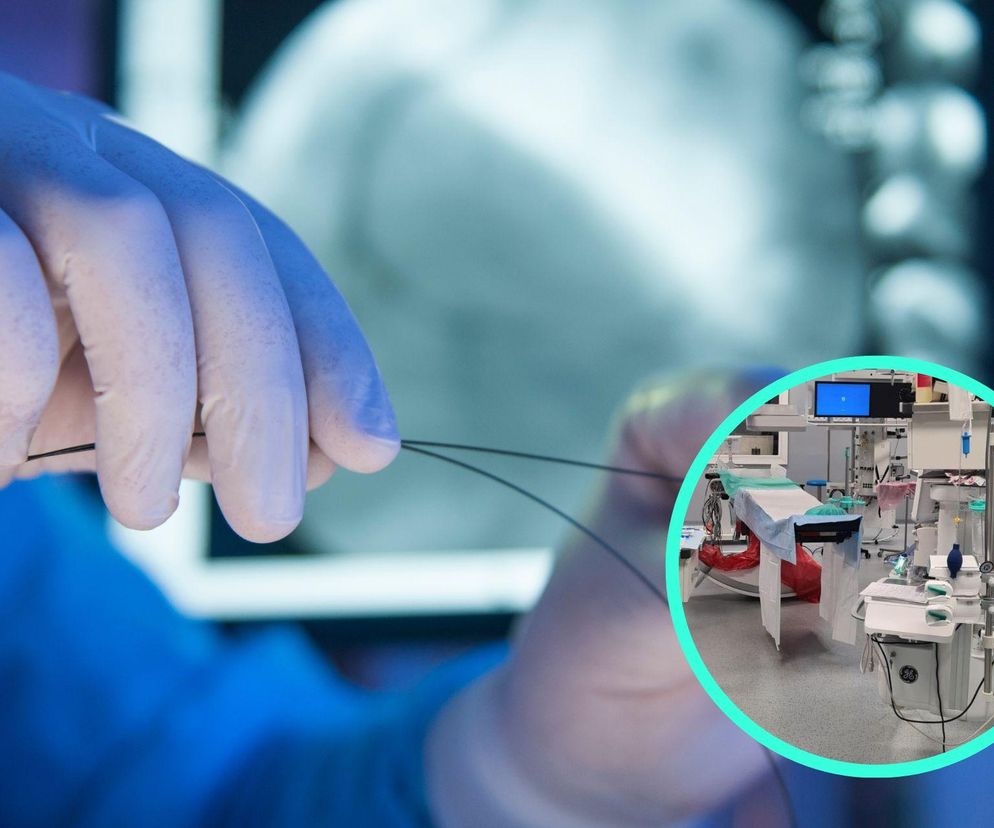 Sukces Kieleckich chirurgów. “Prawdopodobnie pierwszy tego typu zabieg w Polsce”