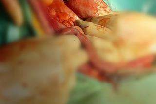 Potwór strzelił do psa. Zwierzę umierało samotnie w przydrożnym rowie. Trwa walka o jej życie