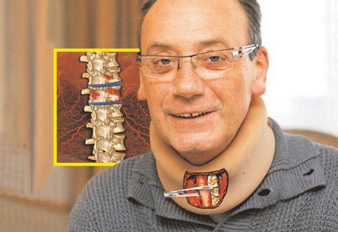 Dariusz Szpakowski mógł stracić głos. Szczegóły operacji