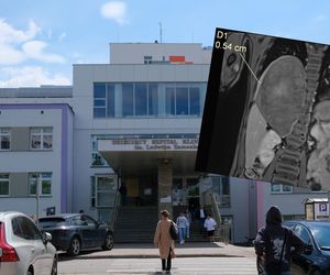 Wielki sukces lekarzy z Białegostoku! Usunęli gigantycznego guza z klatki piersiowej dziecka