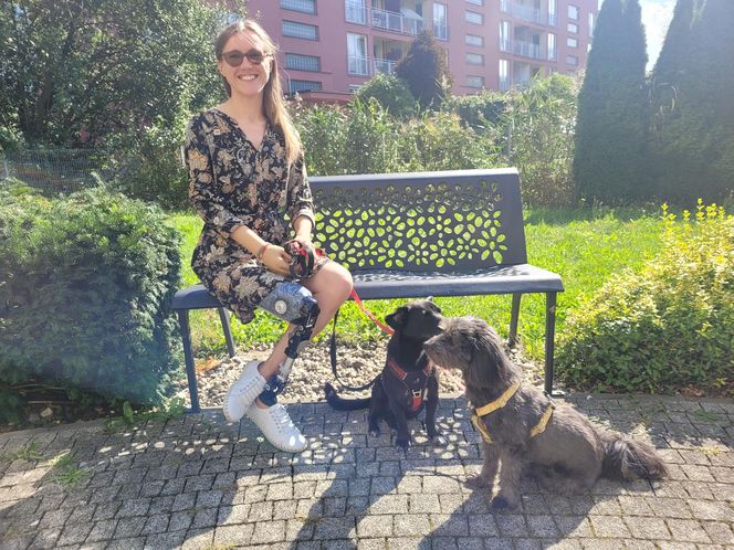 Marlena zbiera na nową protezę