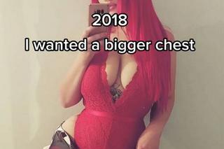 Seksowna 27-latka ma monstrualny biust! Naukowcy znaleźli szokujące wyjaśnienie