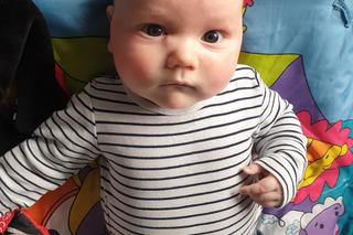 Adaś Krzyżanowski potrzebuje leczenia. Nowotwór zżera jego malutkie oczko