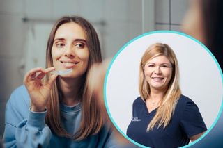 Czy 	można rozjaśnić zęby w domu? Higienistka stomatologiczna ocenia metody 