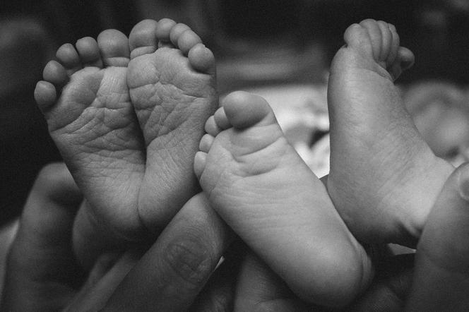 Bliźnięta syjamskie urodzone w Gdańsku zmarły dzień po urodzeniu. Zdjęcie poglądowe