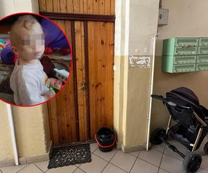 Malutka Zuzia była jednym wielkim siniakiem! 