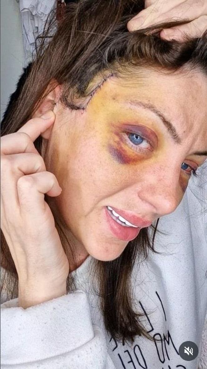 Nie żyje "Ludzka Barbie"! 31-letnia influencerka znaleziona martwa w mieszkaniu!