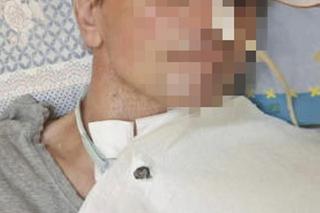 Koszmarny wypadek zmienił jego życie bezpowrotnie. Dzieci 48-latka nie mogą z nim nawet porozmawiać [ZDJĘCIA]