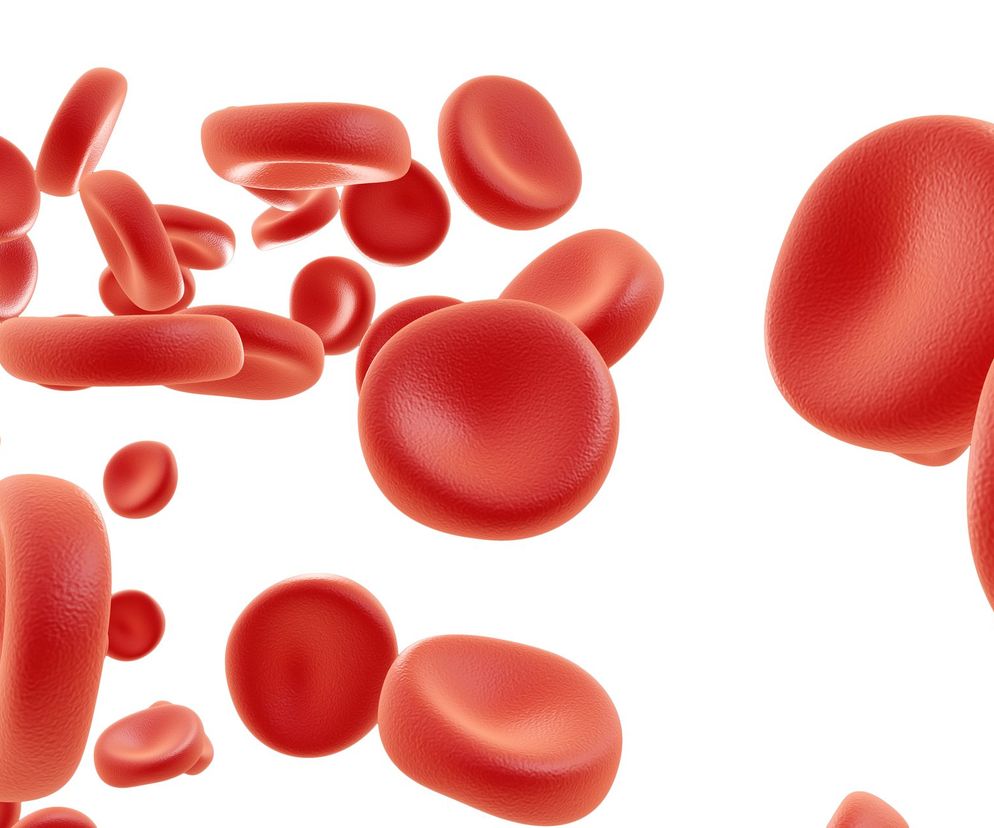 Hemoliza oznacza rozpad krwinek czerwonych pod wpływem różnych czynników, w wyniku czego dochodzi do uwolnienia z nich hemoglobiny do osocza krwi.