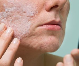 Maść na blizny - skład, działanie, skuteczność maści na blizny