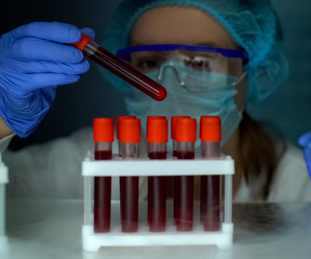 Z HIV wyleczyło się zaledwie kilka osób na całym świecie. Do tego grona dołączył kolejny pacjent