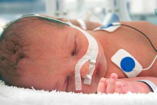 Martwicze zapalenie jelita grubego u wcześniaków i noworodków: przyczyny, objawy, leczenie