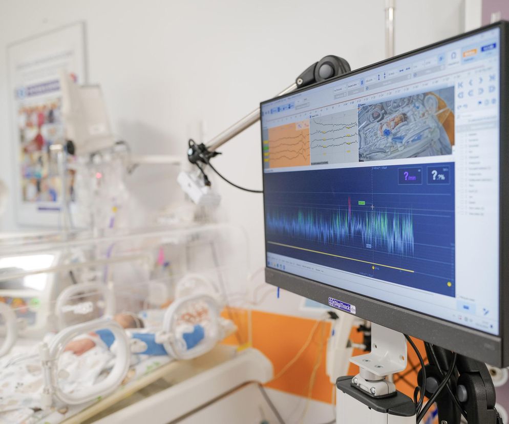 O nowe urządzenie do diagnostyki noworodków wzbogacił się słupski szpital
