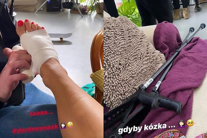 Anna Mucha na Instagramie pokazała obrażenia po wypadku