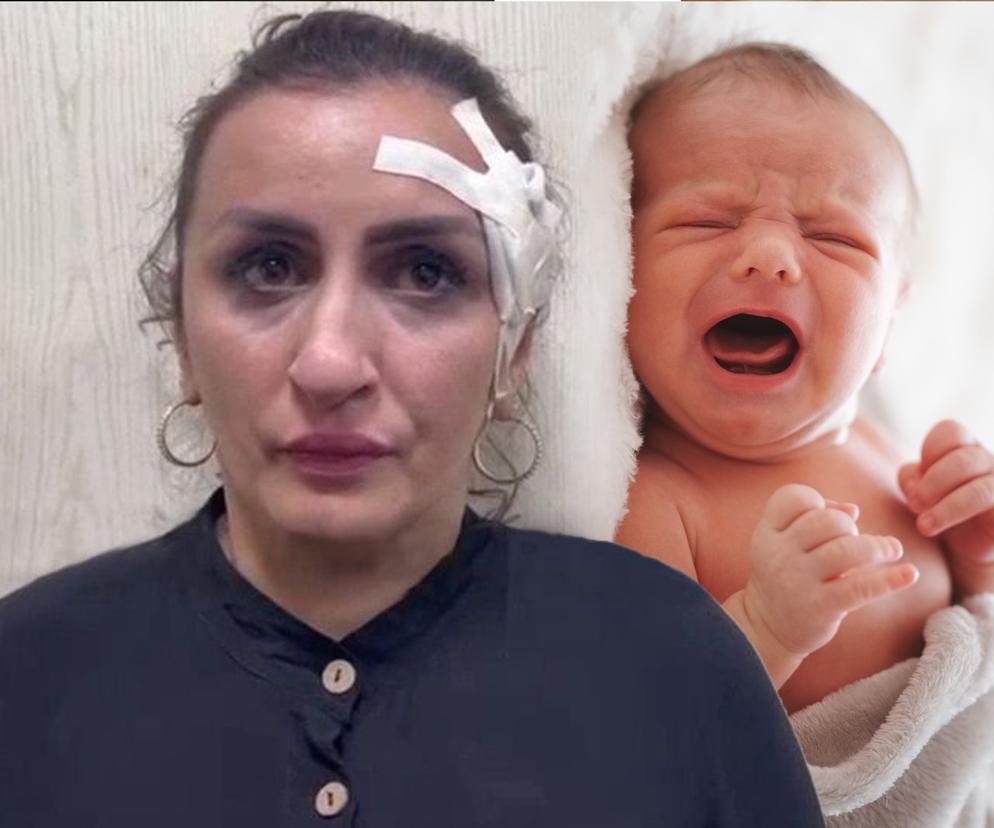 Sprzedała synka, żeby zarobić na operację plastyczną nosa! 33-latka aresztowana