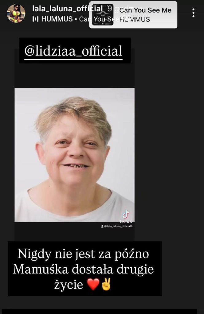 Laluna sprawiła mamie nowe zęby. "Dałaś mi drugie życie"