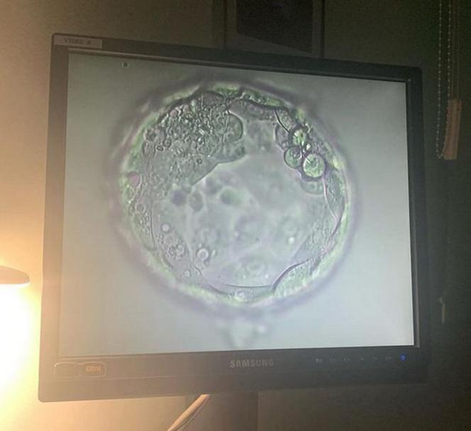 Małgorzata Rozenek pokazała swoje zdjęcia z zabiegu in vitro