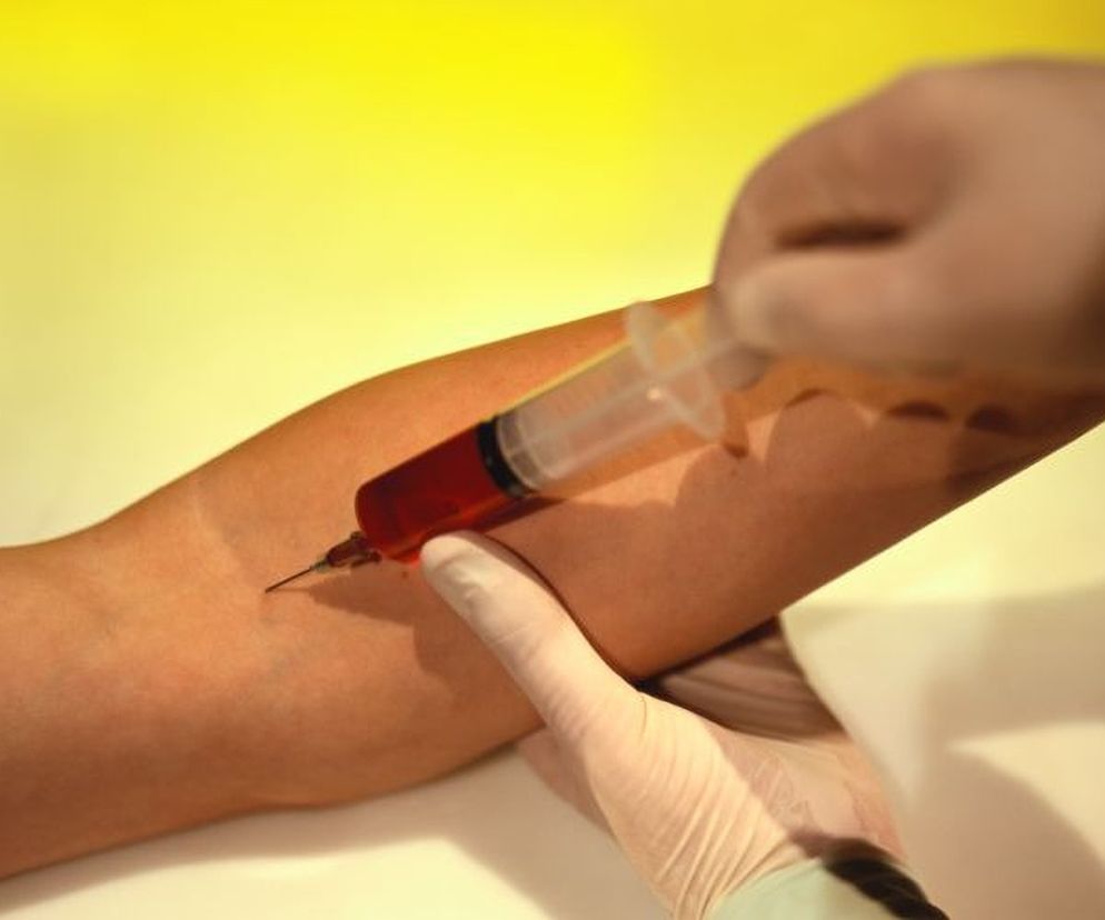 Wskaźnik ten podaje czas po jakim specjalnie przygotowana krew krzepnie.