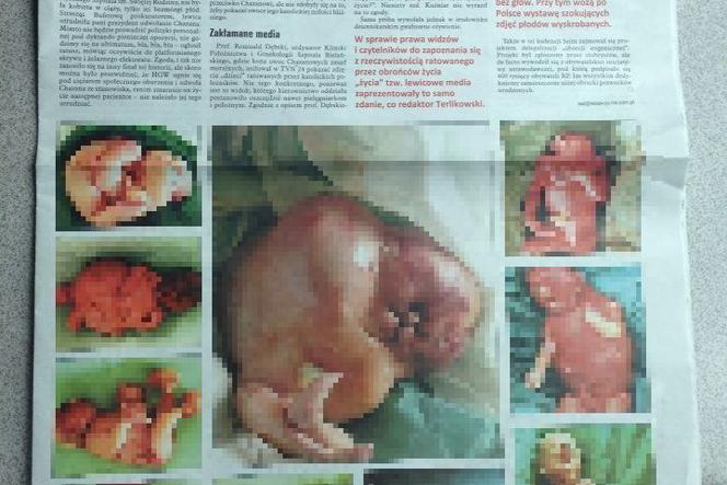 Tygodnik NIE publikuje przerażające zdjęcia zdeformowanych płodów!