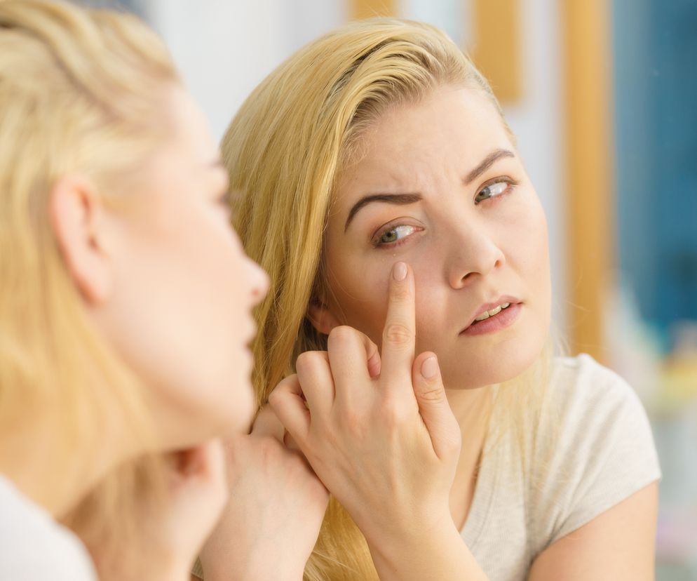 Niektóre objawy raka płuca są widoczne na twarzy. Wystarczy spojrzeć w lustro