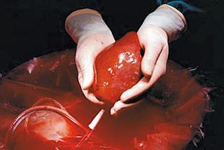 Ofiaruj życie po śmierci - oświadczenie woli o donacji narządów do przeszczepu