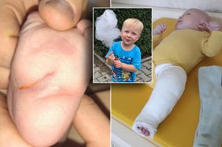 Chory Tymek potrzebuje naszej pomocy. Chcę być jak inne dzieci, grać w piłkę