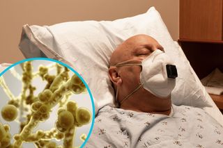 Grzyb Candida Auris szerzy się w niepokojącym tempie. Nawet 60 proc. pacjentów umiera